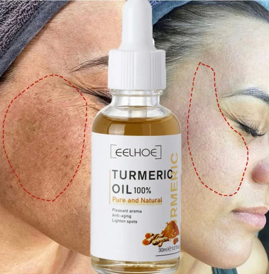 Niacinamide Serum voor Pigmentvlekken met Kurkuma 30 ml