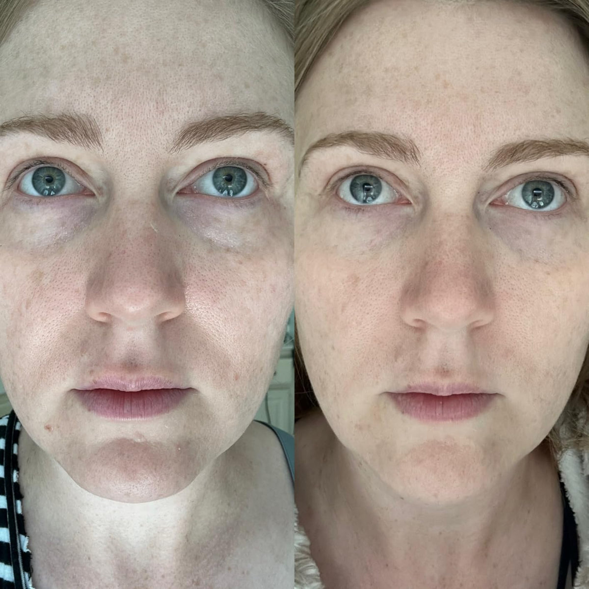 Dr.Melaxin Koreaanse Skincare Collageen Stick Multi Balm voor Oogcontour, Gezicht & Hals 9 g
