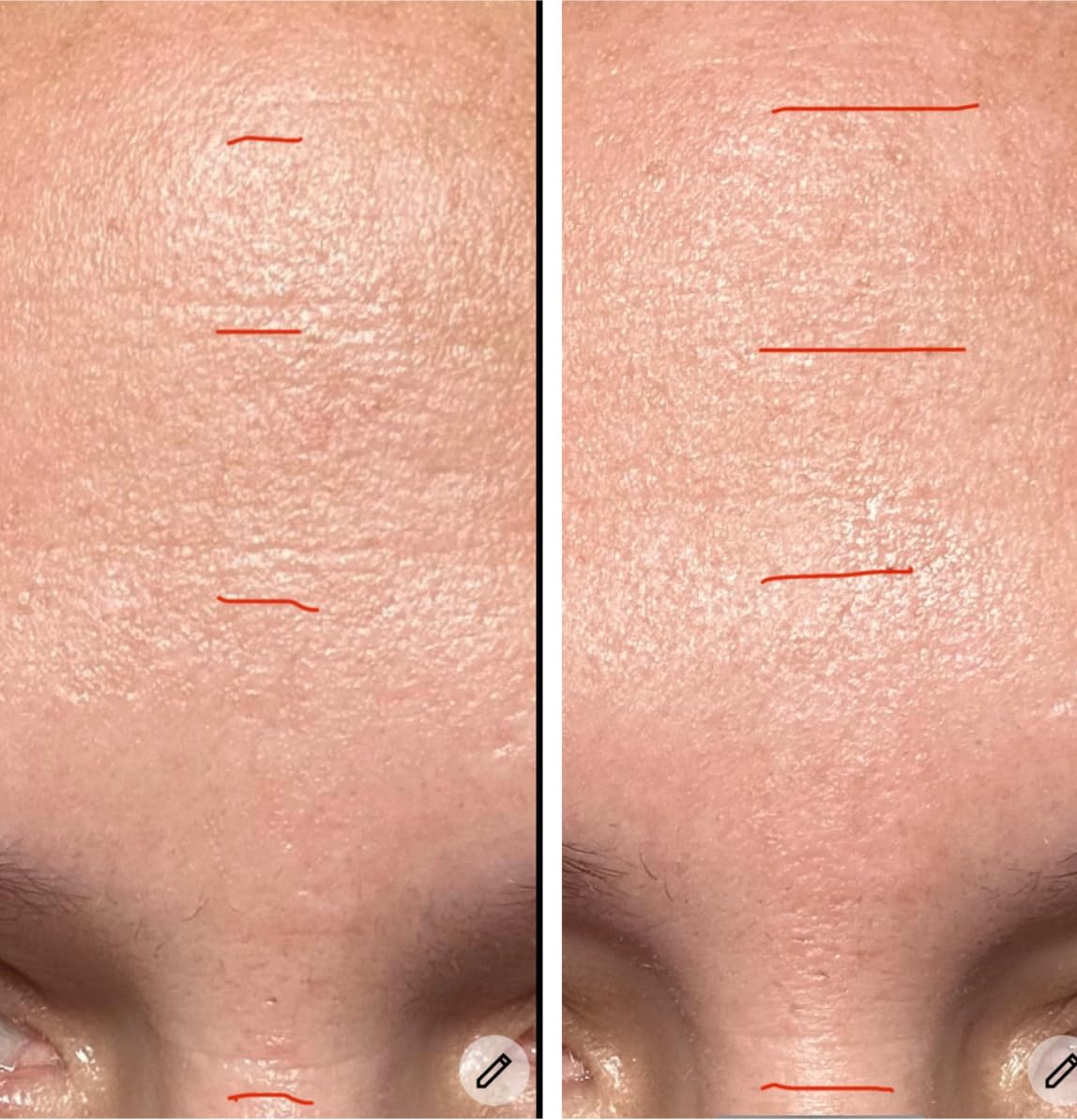 Dr.Melaxin Koreaanse Skincare Collageen Stick Multi Balm voor Oogcontour, Gezicht & Hals 9 g