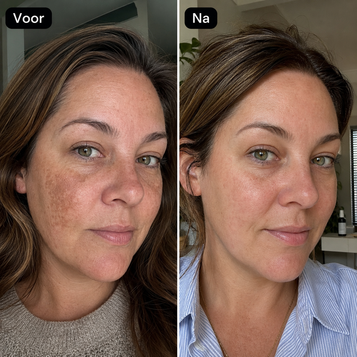 Tosowoong Arbutine 7% + tranexaminezuur 4% crème – 50 ml