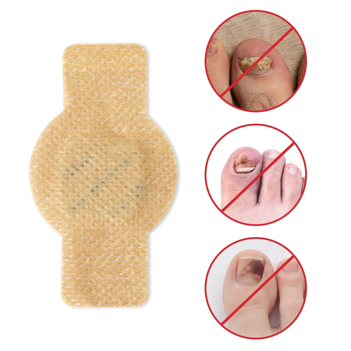 Kalknagel Pleisters voor Verzorging van Verkleurde Teennagels