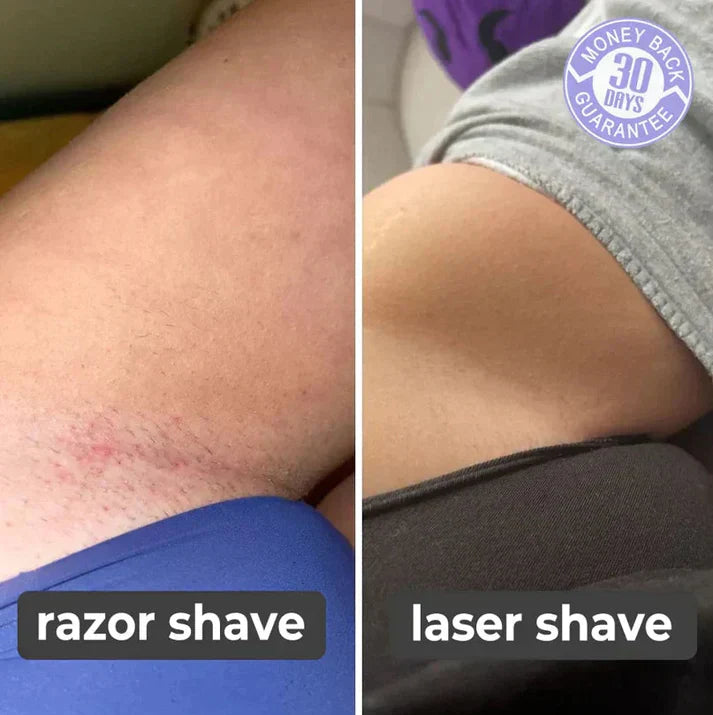 Ladyshave voor Gezicht & Lichaam – Elektrisch Ontharingsapparaat